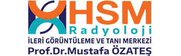 HSM